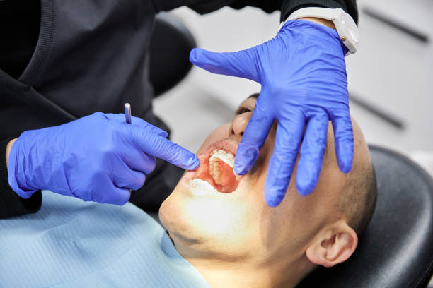 Best Dentist for Tooth Abscess  in Flora, IL