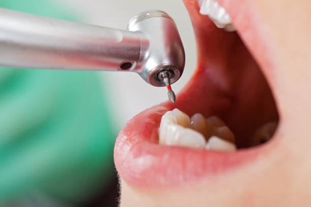 Best Tooth Pain Emergency Relief  in Flora, IL